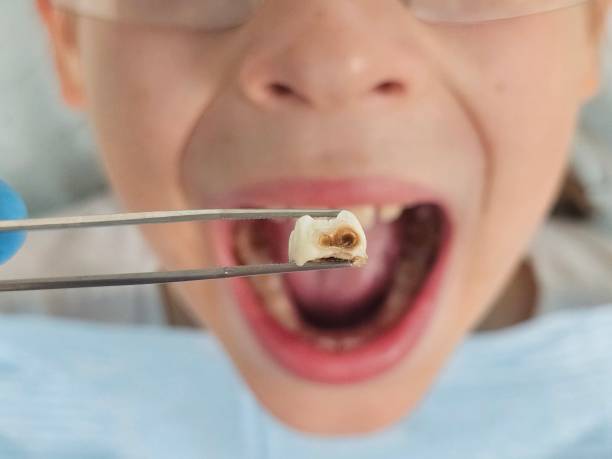 Best Broken or Chipped Tooth Repair in Duncannon, PA