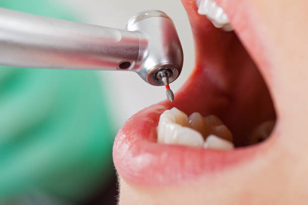 Best Emergency Dental Care for Sports Injuries in Duncannon, PA